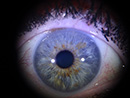 Iridologia - Foto de íris obtida com o Iridophoto HX